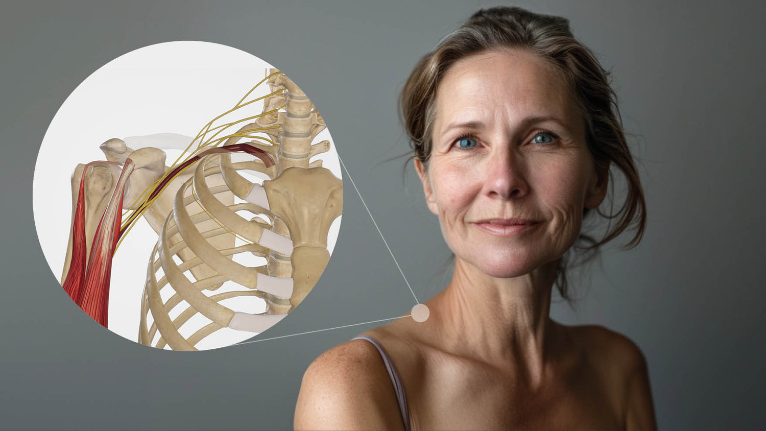 Nervus-axillaris-Neuralgie