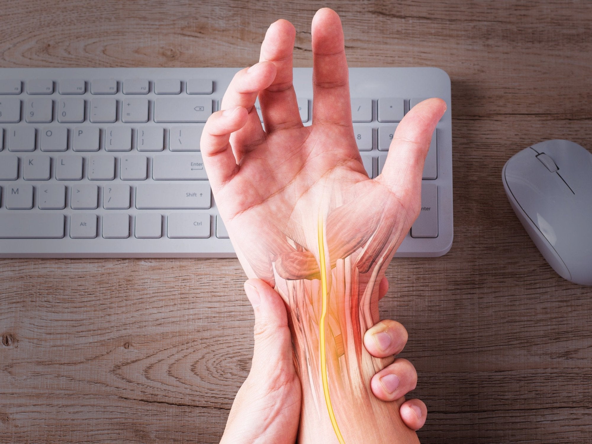 Nahaufnahme einer Hand mit dargestellten Nervenbahnen über einer Computertastatur. Die Hand wird von der anderen Hand gehalten – Symbol für Schmerzen im Handgelenk.