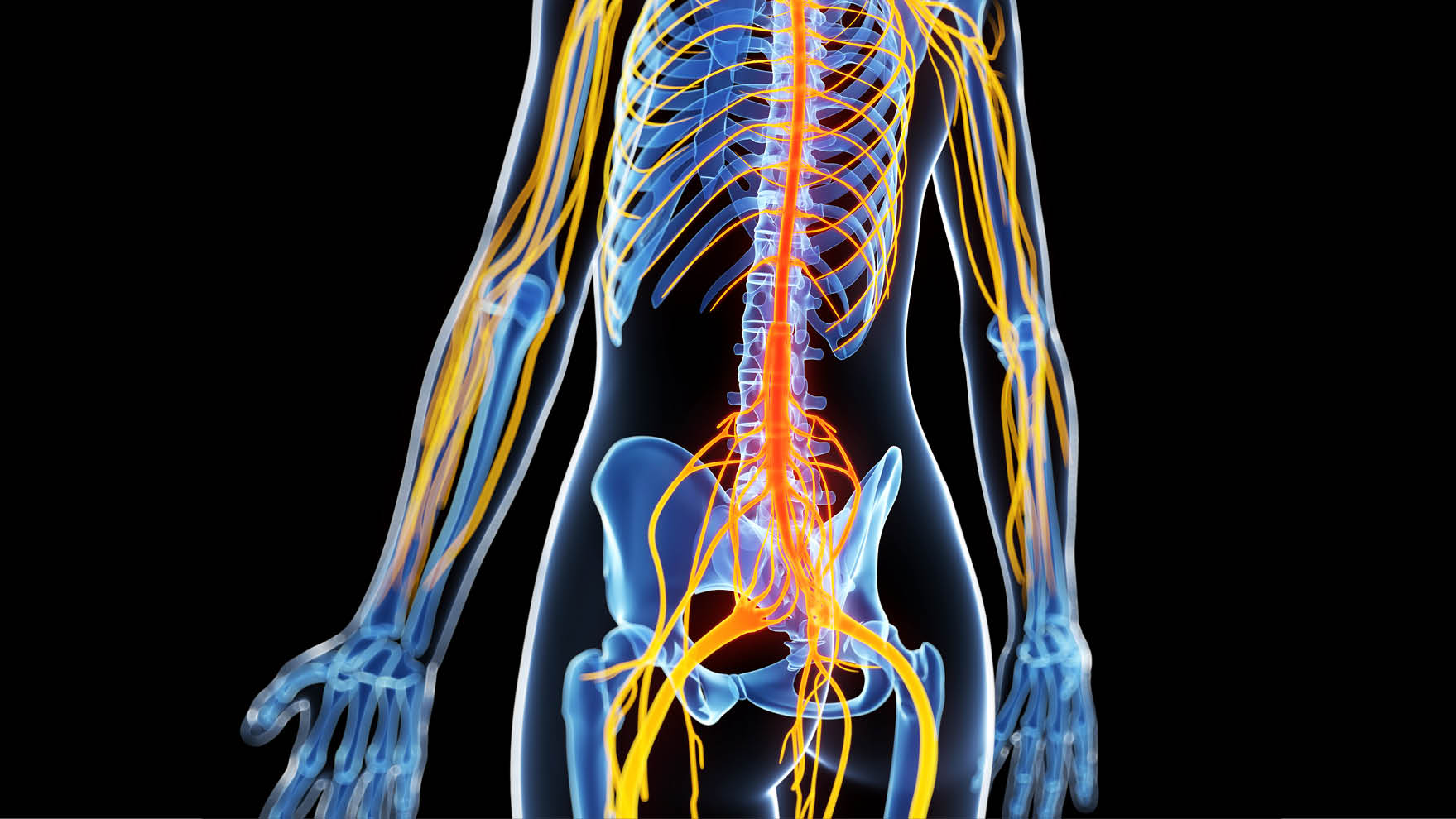 Polyneuropathie